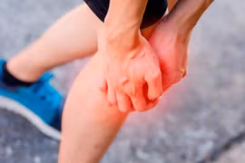 Chân sưng to cẩn thận nhồi máu phổi