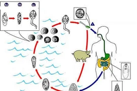 Bệnh sán lá gan lớn có lây từ người sang người?