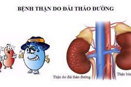Cách giảm bệnh thận do đái tháo đường