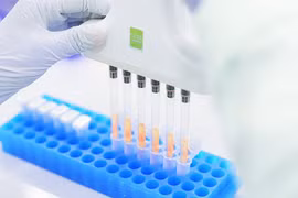 Triển khai xét nghiệm gene miễn phí bệnh tan máu bẩm sinh tại 100 bệnh viện 