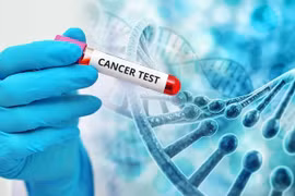 Tiến bộ trong sinh học phân tử phát hiện, điều trị ung thư dạ dày