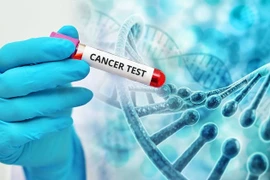 Tiến bộ trong sinh học phân tử phát hiện, điều trị ung thư dạ dày