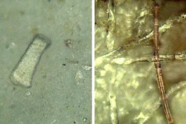 Những người bị bệnh viêm ruột có nhiều vi nhựa trong phân