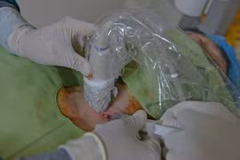 Tiêm cồn tuyệt đối điều trị bệnh lý tuyến giáp