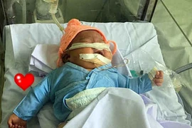 Bé sơ sinh gãy tay, nguy kịch vì bác sĩ đỡ đẻ sai cách