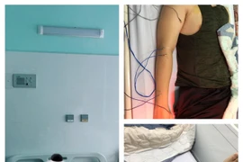 Thường xuyên thức khuya có thể gây đột quỵ não ở người trẻ