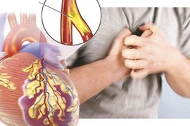 Đau ngực khác nhau nhưng đều kết luận bệnh mạch vành