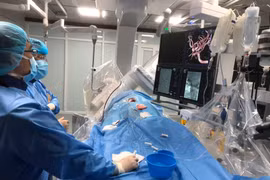 Đột quỵ vì bỏ thuốc chống đông