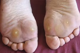 Làm thế nào để kiểm soát đường huyết?