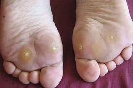 Làm thế nào để kiểm soát đường huyết?