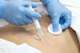 Tác hại của tiêm giảm béo