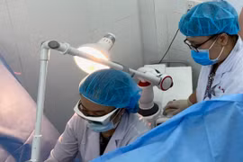 Laser điều trị lỏng lẻo âm đạo