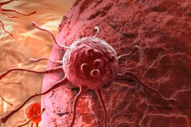 Ban đêm tế bào ung thư lây lan nhanh nhất 