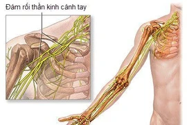 Mổ nối dây thần kinh