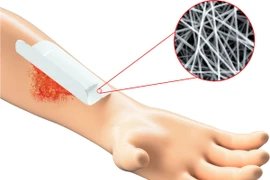 Sợi nano sinh học tăng khả năng chữa lành vết thương