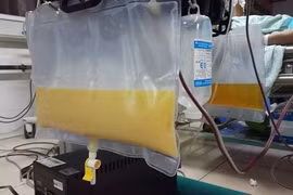 Mẫu huyết tương đục như sữa