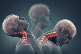 1 số dấu hiệu chỉ điểm bạn đã thoát vị đĩa đệm, thoái hóa cột sống cổ