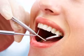 Nhổ răng khôn có ảnh hưởng thần kinh?