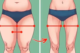 Tuổi trung niên: Phụ nữ tích mỡ đùi và hông, nam giới tích mỡ bụng 