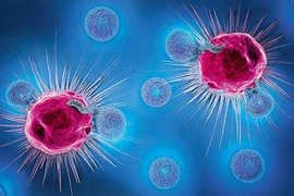 Giải mã ngày càng có nhiều bệnh nhân ung thư