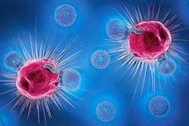 Giải mã ngày càng có nhiều bệnh nhân ung thư