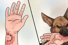 Nam sinh lớp 9 tử vong sau một tháng bị chó dại cắn