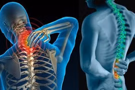 ThS.BS Trần Quốc Khánh: Phải tạo thói quen ngồi đúng sinh lý cột sống