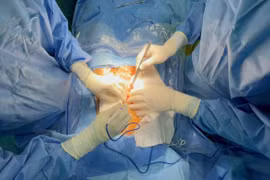 Các bác sĩ thực hiện cuộc mổ lần thứ 16 để khắc phục biến chứng dị tật bẩm sinh cho người bệnh