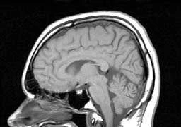 Chụp cộng hưởng từ hạt nhân giúp chẩn đoán nhiều bệnh