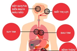 Tăng huyết áp gây suy tim