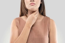 Viêm mũi họng xuất tiết