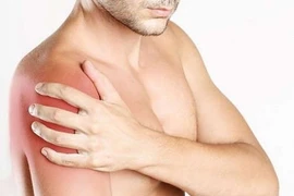 Viêm quanh khớp vai