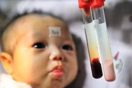 Sàng lọc bệnh Thalassemia trước kết hôn