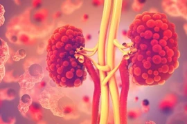 Bệnh thận đa nang trẻ em 