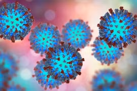 Bệnh sởi lây lan mạnh ở giai đoạn nào?