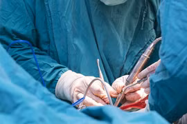 Cắt bỏ tiền liệt tuyến có ảnh hưởng xuất tinh?