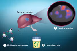 Sử dụng các hạt nano để phát hiện tế bào ung thư 