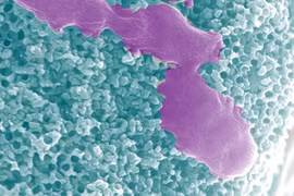 Vi robot chạy bằng ure điều trị nhiễm trùng đường tiết niệu