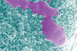 Vi robot chạy bằng ure điều trị nhiễm trùng đường tiết niệu