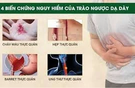 Vỡ thực quản, ngất xỉu vì cố nôn