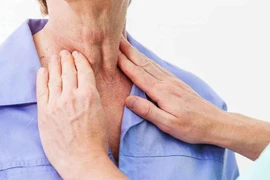 Bác sỹ cảnh báo thói quen xấu dẫn tới ung thư thực quản