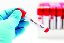 Cải thiện đau gút ở ngón chân cái bằng thảo dược - Hướng đi mới giúp điều trị bệnh hiệu quả