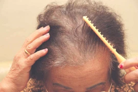 Rụng tóc không liên quan đến mùa thu