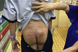 TPHCM: Nghi vấn bé trai bị bạo hành kéo dài khi ở cùng bố, mẹ kế