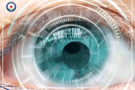 Các loại phẫu thuật chữa cận thị?