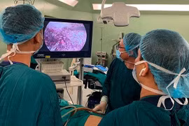 Trường hợp nào được nội soi cắt ung thư gan?