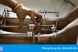 Tay lệch muốn kéo dài