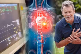 Giải pháp đúng để trị bệnh tim mạch hiệu quả 