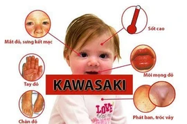 Trẻ sốt cao, phát ban cẩn thận bệnh Kawasaki nguy hiểm