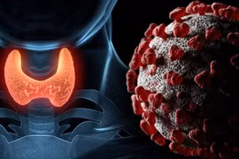 bệnh tuyến giáp